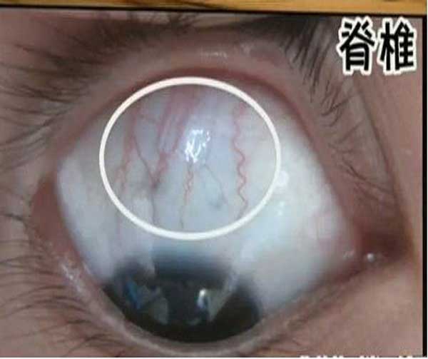 游戏眼app_手机 游戏 眼睛_锻炼眼睛的手机游戏