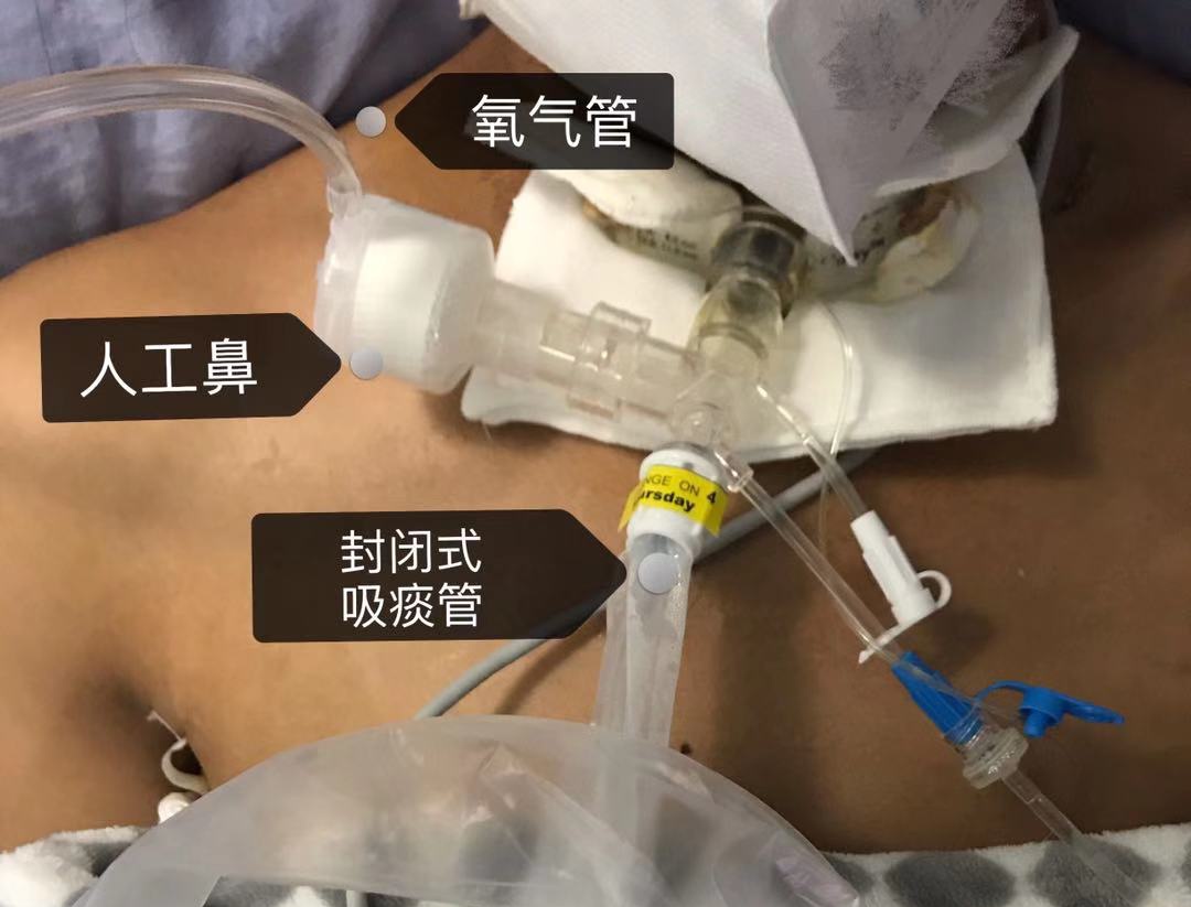 美的热水器服务_tengine服务器_海尔维修热水器服务